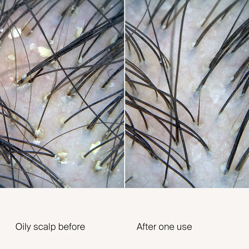 Scalp Care Exfoliator - Image 3